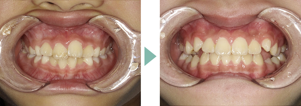 症例③