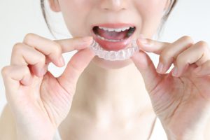 矯正が難しいケースとは？治療を検討するうえで知っておきたいポイント