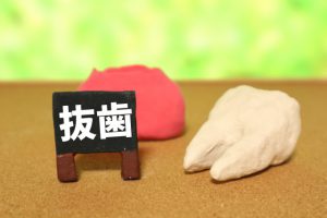 マウスピース矯正でも親知らずの抜歯は必要？